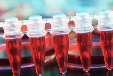 Cord Blood Banking: An Overview