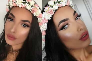 Snapchat Dysmorphia – The Photo Filter Phenomenon