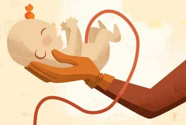 Umbilical Cord Hygiene and Care